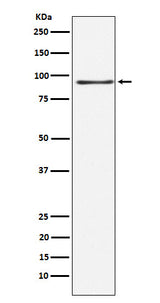 Anti-RANBP3 Rabbit Monoclonal Antibody Boster Bio