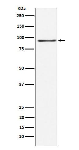 Anti-RANBP3 Rabbit Monoclonal Antibody Boster Bio