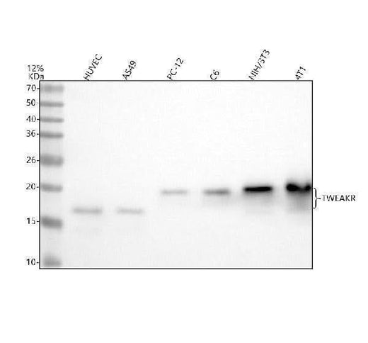 Anti-TWEAKR Rabbit Monoclonal Antibody Boster Bio
