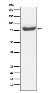 Anti-RAP80 Monoclonal Antibody Boster Bio