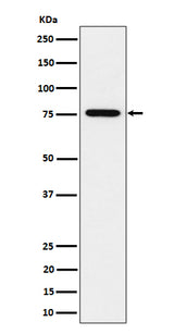 Anti-BRAT1 Rabbit Monoclonal Antibody Boster Bio