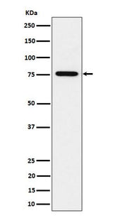 Anti-BRAT1 Rabbit Monoclonal Antibody Boster Bio