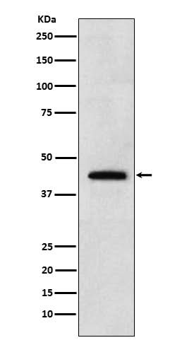 Anti-Renalase Rabbit Monoclonal Antibody Boster Bio