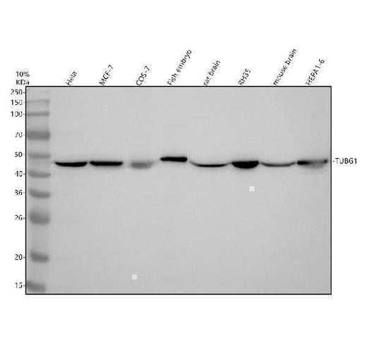 Anti-Tubulin gamma Rabbit Monoclonal Antibody Boster Bio