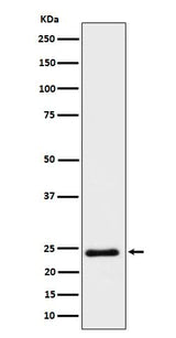 Anti-Mras Rabbit Monoclonal Antibody Boster Bio