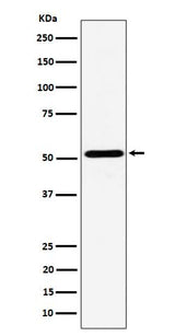 Anti-NPY5R Rabbit Monoclonal Antibody Boster Bio
