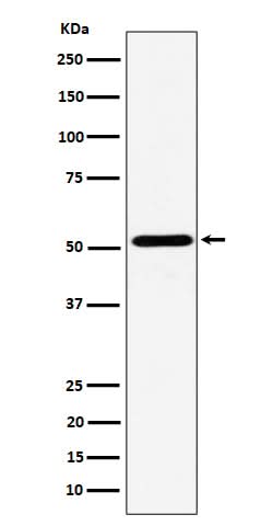 Anti-NPY5R Rabbit Monoclonal Antibody Boster Bio