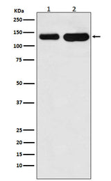 Anti-K-Cadherin-6 CDH6-Monoclonal Antibody Boster Bio