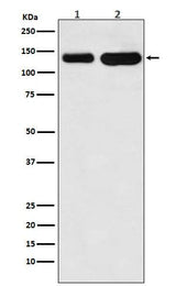 Anti-K-Cadherin-6 CDH6-Monoclonal Antibody Boster Bio