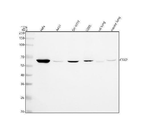 Anti-CBX2 Rabbit Monoclonal Antibody Boster Bio