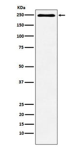 Anti-Plexin A1 Monoclonal Antibody Boster Bio