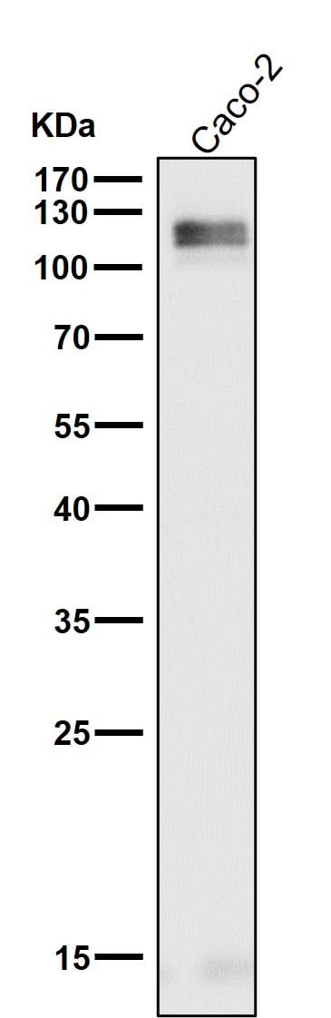 Anti-LI-Cadherin-17 CDH17-Rabbit Monoclonal Antibody Boster Bio