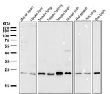Anti-VPS28 Rabbit Monoclonal Antibody Boster Bio