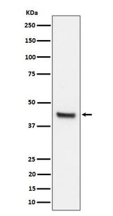 Anti-IL11RA Rabbit Monoclonal Antibody Boster Bio