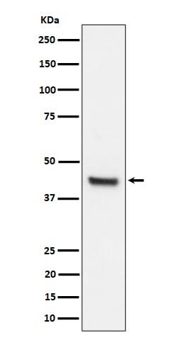 Anti-IL11RA Rabbit Monoclonal Antibody Boster Bio