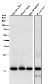 Anti-MYL9 Rabbit Monoclonal Antibody Boster Bio