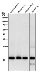 Anti-MYL9 Rabbit Monoclonal Antibody Boster Bio