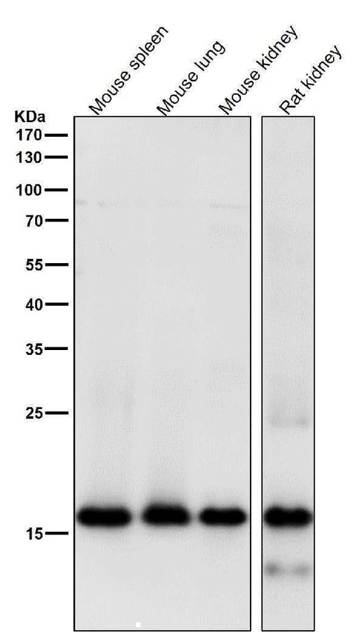 Anti-MYL9 Rabbit Monoclonal Antibody Boster Bio