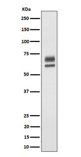 Anti-PPP2R5D Rabbit Monoclonal Antibody Boster Bio
