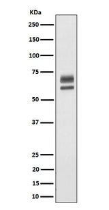 Anti-PPP2R5D Rabbit Monoclonal Antibody Boster Bio