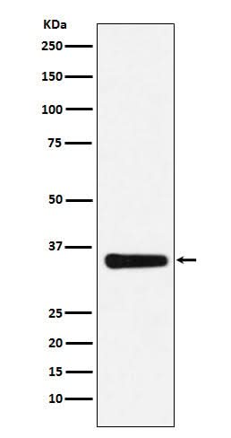 Anti-MED4 Rabbit Monoclonal Antibody Boster Bio