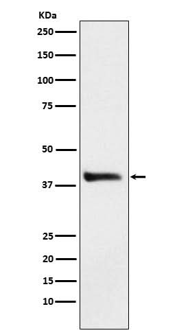 Anti-Alcohol Dehydrogenase Rabbit Monoclonal Antibody Boster Bio