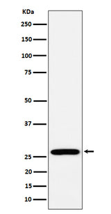 Anti-RPL13 Rabbit Monoclonal Antibody Boster Bio