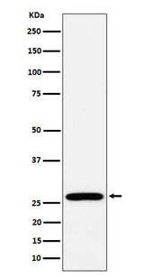 Anti-RPL13 Rabbit Monoclonal Antibody Boster Bio