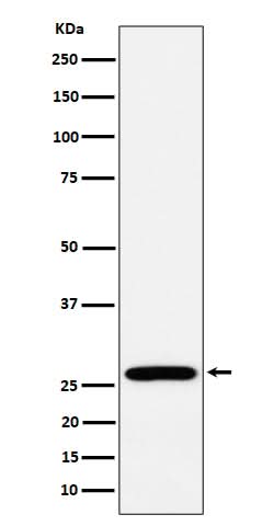 Anti-RPL13 Rabbit Monoclonal Antibody Boster Bio