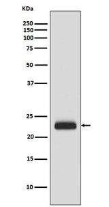 Anti-RAIDD Rabbit Monoclonal Antibody Boster Bio