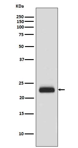 Anti-RAIDD Rabbit Monoclonal Antibody Boster Bio