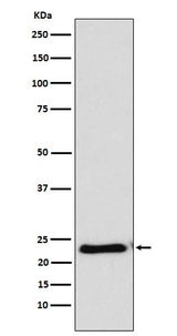 Anti-RAIDD Rabbit Monoclonal Antibody Boster Bio