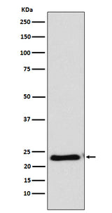 Anti-RAIDD Rabbit Monoclonal Antibody Boster Bio