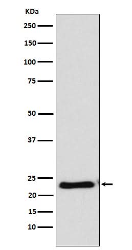 Anti-RAIDD Rabbit Monoclonal Antibody Boster Bio