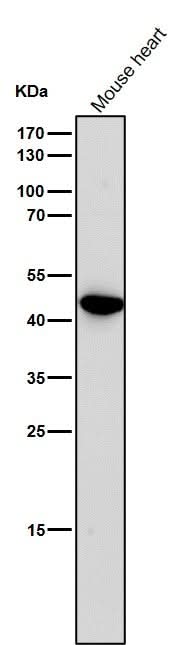 Anti-Uroplakin3a UPK3A Monoclonal Antibody Boster Bio