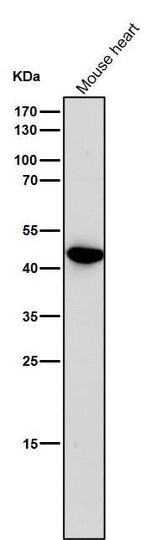 Anti-Uroplakin3a UPK3A Monoclonal Antibody Boster Bio