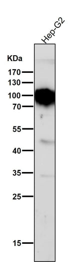 Anti-TGN46 Rabbit Monoclonal Antibody Boster Bio