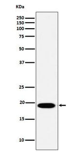 Anti-MSRB3 Rabbit Monoclonal Antibody Boster Bio