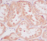 Anti-RPS20/Ribosomal Protein S20 Rabbit Monoclonal Antibody Boster Bio