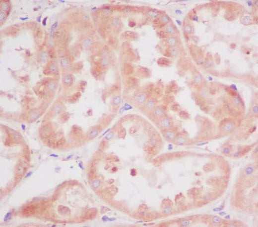 Anti-RPS20/Ribosomal Protein S20 Rabbit Monoclonal Antibody Boster Bio