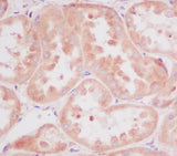 Anti-RPS20/Ribosomal Protein S20 Rabbit Monoclonal Antibody Boster Bio