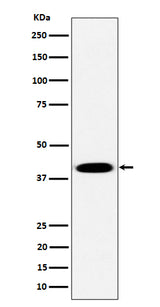 Anti-Pleckstrin Rabbit Monoclonal Antibody Boster Bio