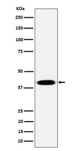 Anti-Pleckstrin Rabbit Monoclonal Antibody Boster Bio