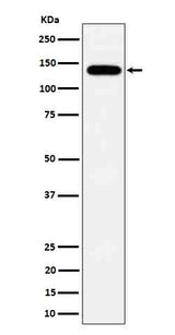 Anti-Tripeptidyl peptidase II Rabbit Monoclonal Antibody Boster Bio