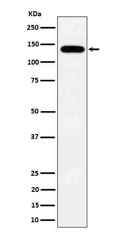 Anti-Tripeptidyl peptidase II Rabbit Monoclonal Antibody Boster Bio