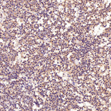 Anti-PI 3 Kinase p55 gamma PIK3R3 Rabbit Monoclonal Antibody Boster Bio