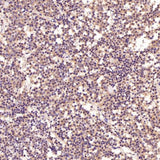 Anti-PI 3 Kinase p55 gamma PIK3R3 Rabbit Monoclonal Antibody Boster Bio