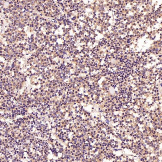 Anti-PI 3 Kinase p55 gamma PIK3R3 Rabbit Monoclonal Antibody Boster Bio