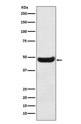 Anti-BHMT Rabbit Monoclonal Antibody Boster Bio