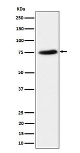 Anti-PPM1G Rabbit Monoclonal Antibody Boster Bio